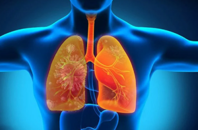 Bệnh bụi phổi: Nguyên nhân, dấu hiệu và cách phòng ngừa